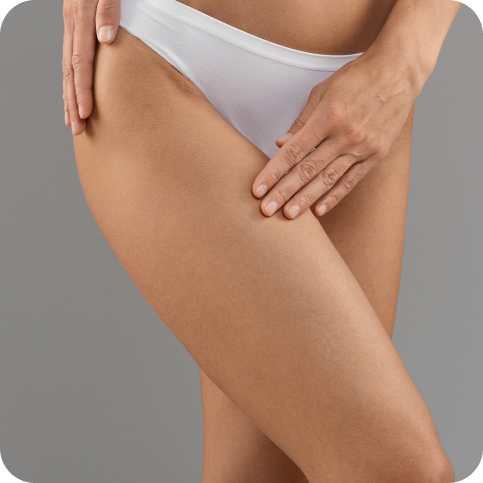 Dermolipectomia de coxas