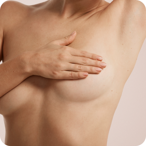 Mamoplastia Redutora